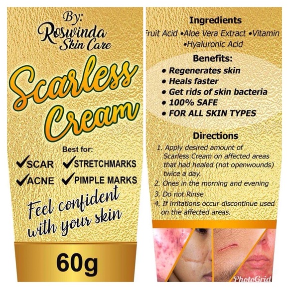 Scarless Cream Acne Stretch Mark Pimple Marks - Picture 2 of 8
